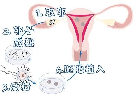 三代供卵试管选性别包生男孩生殖医学中心